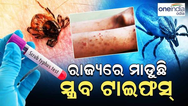 ରାଜ୍ୟରେ ମାଡ଼ି ଚାଲିଛି ସ୍କ୍ରବ୍ ଟାଇଫସ୍ : ସୁନ୍ଦରଗଡ଼ ଆଉ ୧୦ ଜଣ ଆକ୍ରାନ୍ତ ଚିହ୍ନଟ