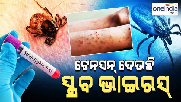 ଟେନସନ୍ ଦେଉଛି ସ୍କ୍ରବ ଟାଇଫସ୍: ସୁନ୍ଦରଗଡ଼ରେ ପଜିଟିଭ ସଂଖ୍ୟା ୨୧୧କୁ ବୃଦ୍ଧି