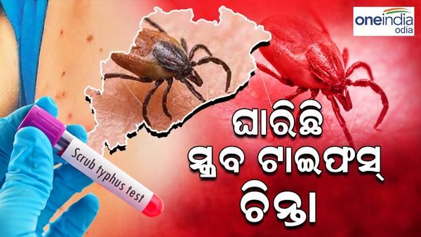 ଥମୁନି ସ୍କ୍ରବ୍ ଟାଇଫସ୍ ଆତଙ୍କ, ଚିହ୍ନଟ ହେଲେ ଆଉ 16 ଆକ୍ରାନ୍ତ