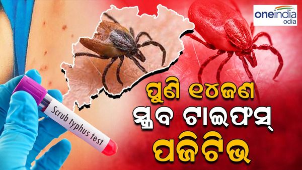 କମୁନି ସ୍କ୍ରବ୍ ଟାଇଫସ: ସୁନ୍ଦରଗଡ଼ରେ ମୋଟ୍ ପଜିଟିଭଙ୍କ ସଂଖ୍ୟା ୪୩୦ରେ ପହଞ୍ଚିଲା