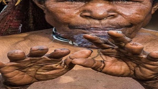 ପରିବାରରେ କାହାର ମୃତ୍ୟୁ ହେଲେ ଏଠାରେ ମହିଳାଙ୍କ କଟାଯାଏ ଆଙ୍ଗୁଠି , ଜାଣନ୍ତୁ ଏଭଳି ଭୟଙ୍କର ରୀତିନୀତି କେଉଁଠି ପାଳନ କରାଯାଏ