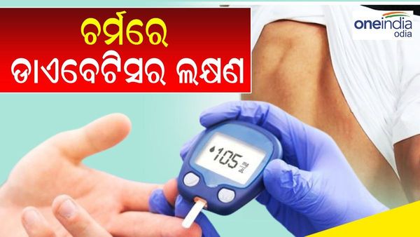 Diabetes: ଚର୍ମରେ ଦେଖାଦେଉଛି କି ଏଭଳି ଲକ୍ଷଣ ? ଭୁଲରେ ବି କରନ୍ତୁନି ଅଣଦେଖା
