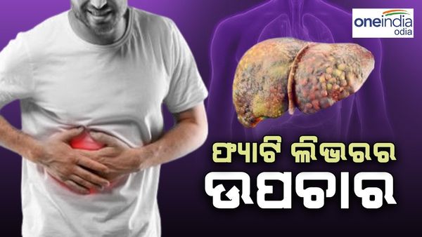 ଫ୍ୟାଟି ଲିଭରରୁ ଦୂରେଇ ରଖିବ ଏହି ସବୁ ଜିନିଷ, ଖାଇବାରେ କରନ୍ତୁ ସାମିଲ