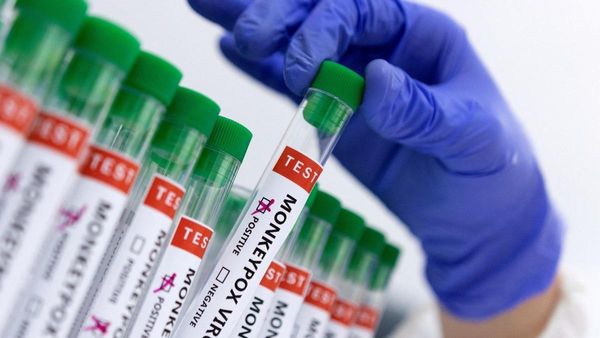 ଭାରତରେ ମଙ୍କିପକ୍ସ ଆକ୍ରାନ୍ତ ଚିହ୍ନଟ, ସନ୍ଦିଗ୍ଧ ଯୁବକଙ୍କ ରିପୋର୍ଟ ପଜିଟିଭ୍‌: ସ୍ବାସ୍ଥ୍ୟ ମନ୍ତ୍ରଣାଳୟ