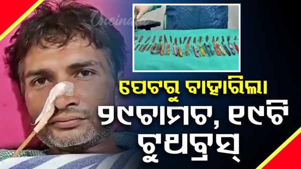 ଡ଼ାକ୍ତର ହୋଇଗଲେ ଆଶ୍ଚର୍ଯ୍ୟ, ରୋଗୀଙ୍କ ପେଟରୁ ବାହାରିଲା ୨୯ଚାମଚ, ୧୯ଟି ଟୁଥବ୍ରସ୍