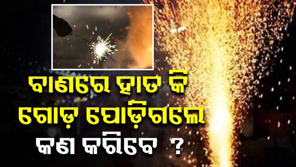 ଆଲୋକର ପର୍ବ ଦୀପାବଳିରେ କେମିତି ରହିବେ ସୁରକ୍ଷିତ ? ଅଘଟଣ ଘଟୁଛି ତେବେ କେମିତି ଘରେ କରିବେ ପ୍ରାଥମିକ ଚିକିତ୍ସା ? 