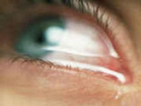 14 வயது சிறுமியிடமிருந்து விவாகரத்து கேட்கும் 17 வயது சிறுவன்