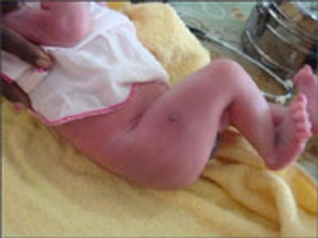 சிசுக்களையும் துளைத்தெடுத்த சிங்களப் படையின் குண்டுகள்!