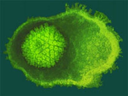 கோடை-சென்னையில் பரவும் சின்னம்மை!