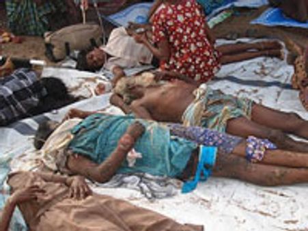 நிலைமை மோசமாகி விட்டது - அழக் கூட திராணியில்லை: நார்வே தமிழர் கண்ணீர் பேட்டி