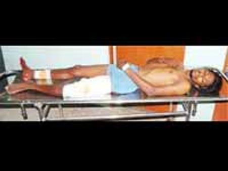 கொள்ளையர்களை 'சேஸ்' செய்து சுட்டு பிடித்த போலீ்ஸ்