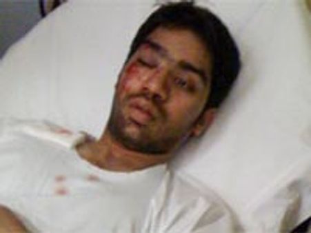 இன்னொரு இந்திய மாணவர் மீது தாக்குதல்-இதுவரை 16