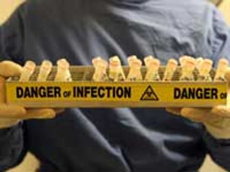 ஸ்வைன் ப்ளூ-சமாளிக்க ரூ.5,000 கோடி தேவை-ஐநா