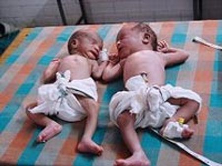 நடு ரோட்டில் இரட்டைக் குழந்தைகளைப் பிரசவித்த பெண்