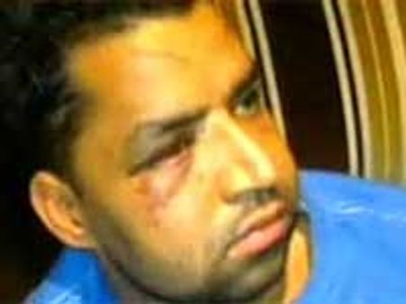 ஆஸி-3 இந்தியர்கள் மீது 70 பேர் கும்பல் மீண்டும் தாக்குதல்