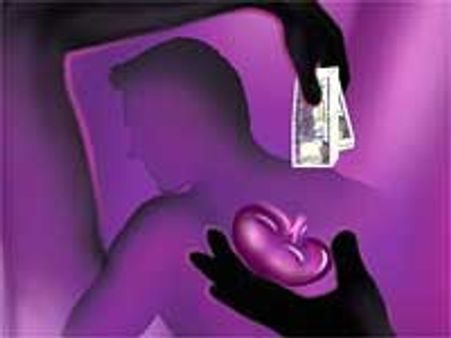 கோவையில் மீண்டும் 'கிட்னி' மோசடி - ரூ.7 லட்சத்துக்கு விலை போன சிறுநீரகம்!