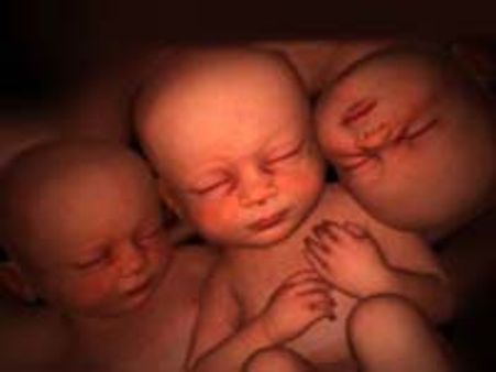 மகளின் 3 சிசுக்களை வயிற்றில் சுமக்கும் தாய்!