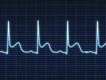 செல்போனில் ஈசிஜி எடுத்து டாக்டருக்கு அனுப்பலாம்!