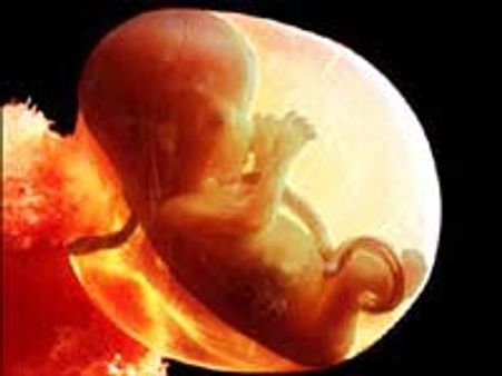 ஹெச்.ஐ.வி. யை அழிக்கும் பெண்களின் கருப்பை திரவம்: விஞ்ஞானிகள் கண்டுபிடிப்பு