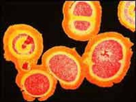 இந்தியாவிலிருந்து சூப்பர் பக் பாக்டீரியா பரவுவதாக கூறுவது அபத்தமான செய்தி-இந்தியா