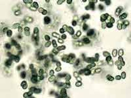 விண்வெளியில் 553 நாட்கள் உயிரோடு இருந்த பாக்டீரியாக்கள்!