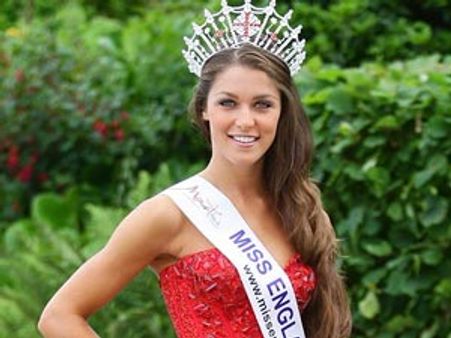 டெஸ்ட் டியூப் பேபி சர்லோட் கோல்ம்ஸ் மிஸ் வேர்ல்ட் இறுதிச்சுற்றில் பங்கேற்பு