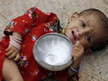 சத்துணவு இல்லாமல் குழந்தைகள் இறப்பது இந்தியாவில் தான் அதிகம்!: யூனிசெப்