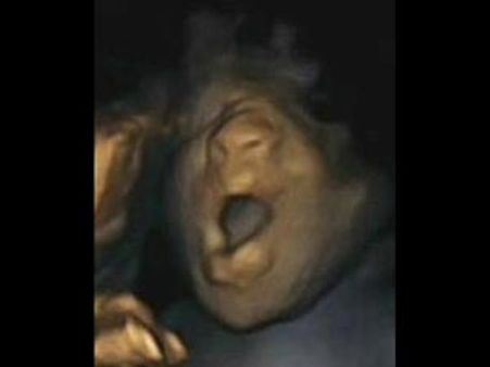 கருவறைக்குள் கொட்டாவி விட்ட குட்டிப் பாப்பா... மலைக்க வைக்கும் ஸ்கேனிங் படம்!