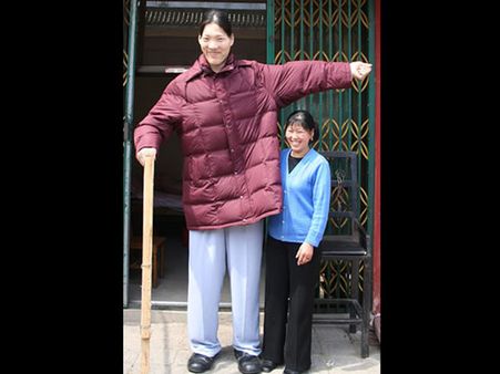 உலகின் உயரமான பெண் புற்றுநோயால் மரணம்