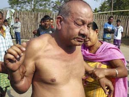 அஸ்ஸாமில் பெண்ணை கற்பழிக்க முயன்ற காங்கிரஸ் தலைவரை அடித்து நொறுக்கிய பெண்கள்