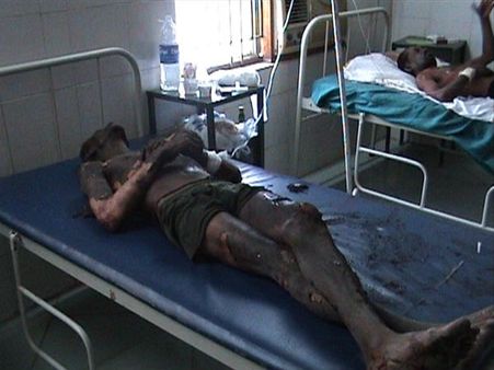 சிவகாசி பட்டாசு ஆலை விபத்து: பலி 5 ஆக உயர்வு 3 பேர் கைது