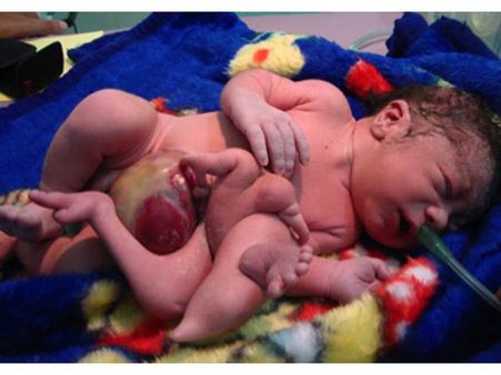 பத்தாண்டுகளுக்கு முன் நடந்த போரின் எதிரொலி: ஈராக்கில் புற்றுநோயோடு அல்லாடும் குழந்தைகள்