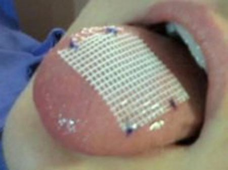 கையில காசு... வாயில பிளாஸ்டிக் நாக்கு...: உடல் எடையைக் குறைக்கும் புதிய முறை