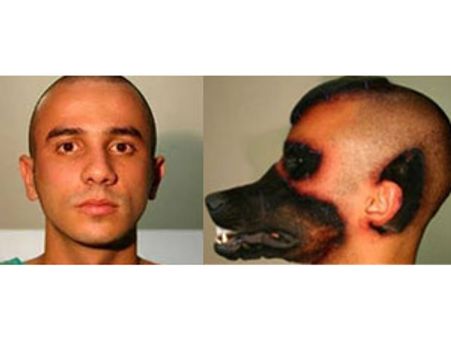 பிளாஸ்டிக் சர்ஜரி மூலம் ‘நாய்’ மனிதனாக மாறிய பிரேசில் இளைஞர்