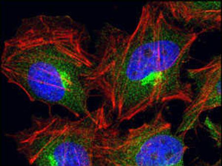 புற்றுநோயிலிருந்து முழுமையாக மீளலாம்... பிரிட்டன் விஞ்ஞானிகள் நம்பிக்கை