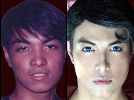 சூப்பர்மேன் ஆசையில், 16 வருடங்களில் 13 அறுவைச் சிகிச்சை செய்து கொண்ட தீவிர ரசிகர்