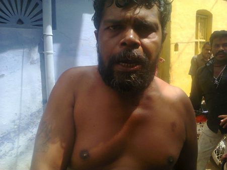 காமன்வெல்த் மாநாட்டில் இந்தியா பங்கேற்க எதிர்ப்பு- ஆட்டோ ஓட்டுனர் தீக்குளிக்க முயற்சி