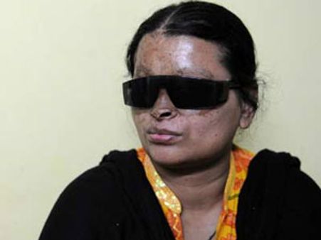 ஆசிட் வீச்சில் போன வாழ்க்கை: சுப்ரீம் கோர்ட் நீதிபதி மூலம் திரும்ப கிடைத்தது