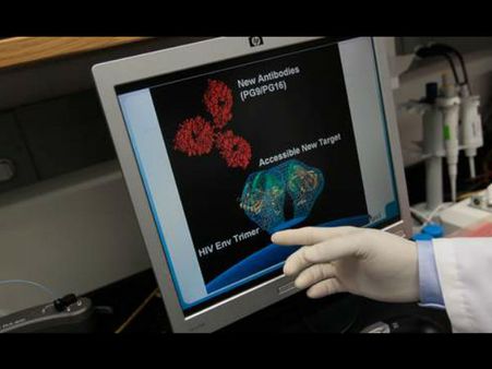 எலும்பு மஜ்ஜை மாற்று சிகிச்சையால் மாயமான ஹெச்.ஐ.வி!