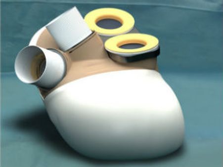 உலகின் முதல் செயற்கை இதயம்.. 'வாழ்நாள் கியாரண்டி'யை 5 வருடம் நீட்டிக்குமாம்!