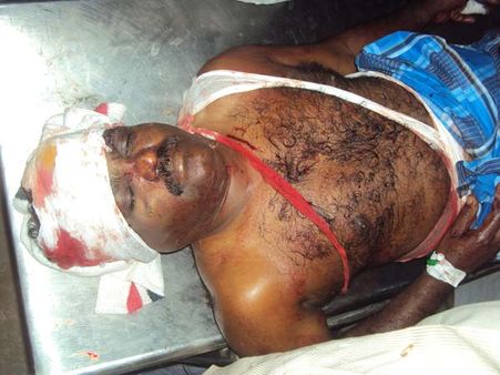 மானாமதுரை அதிமுக எம்.எல்.ஏவுக்கு அரிவாள் வெட்டு: அதிமுகவினர் மூவர் கைது!!