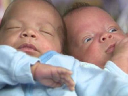 ஆச்சரிய இரட்டையர்கள்: 24 நாட்கள் தள்ளிப் பிறந்த இரண்டாவது குழந்தை!