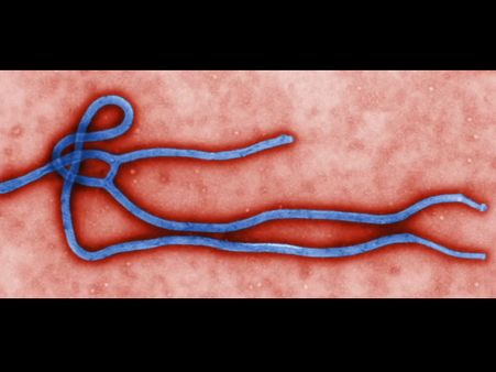 467 பேரை காவு வாங்கிய எபோலா வைரஸ்... மேற்கு ஆப்பிரிக்கா சோகம்