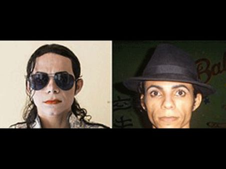 ‘ஆசிட் ஊசி’ மூலம் டூப்ளிகேட் மைக்கேல் ஜாக்சனாக உருமாறிய பிரேசில் ரசிகர்!