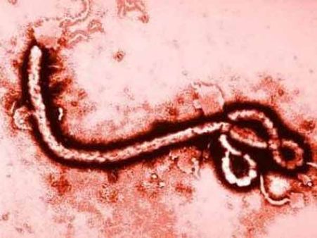 எபோலா ஆற்றங்கரையில் பிறந்து உலகை உலுக்கி வரும் எபோலா வைரஸ் காய்ச்சல்!