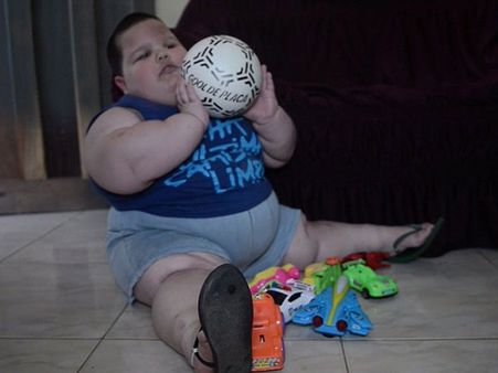 பசி, பசி, அகோரப் பசி... 3 வயதில் 70கி எடை - பிரேசில் சிறுவனின் வினோத நோய்!