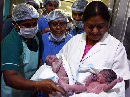 குழந்தை இல்லாமல் தவித்த பெண்ணுக்கு ஒரே பிரசவத்தில் “டூயல்” சந்தோஷம்!