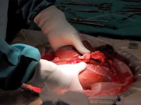 மரணதண்டனை கைதிகளின் உறுப்புகளை தானம் செய்யும் முறை- கைவிட சீன அரசு முடிவு