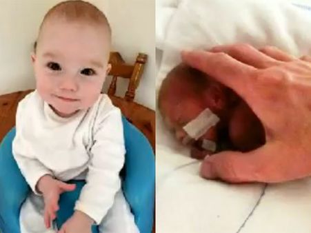 வெறும் 635 கிராம் எடை கொண்ட உலகின் குட்டிக் குழந்தைக்கு முதலாவது ஹேப்பி பர்த் டே!