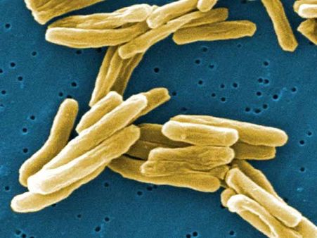 ''சர்வரோக நிவாரணி” ஆண்டிபயாடிக் கண்டுபிடிப்பு: மருத்துவ உலகின் மைல்கல்!